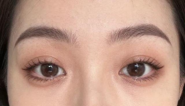 康复理疗服务常见误区澄清与选择依据解析